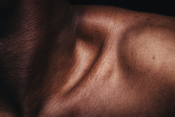 Image of Sweat, Dirt, and Germs: What Athletes Need to Know About Skin Health